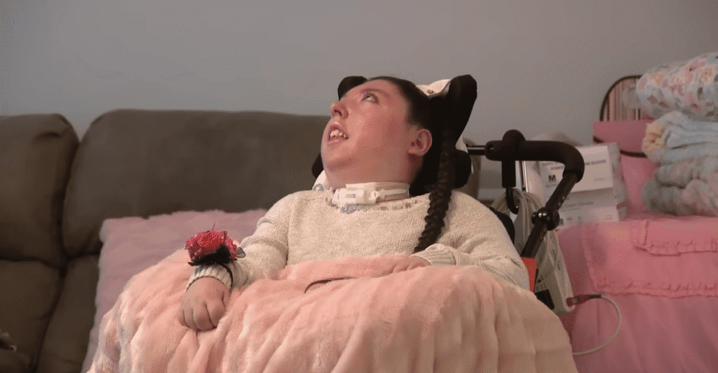 alex simpson hidranencefalia