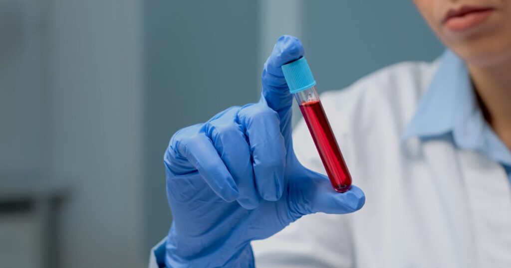 exame de sangue biomarcadores atletas lesoes