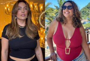 depois de emagrecer 40 kg camila moura se prepra para cirurgias